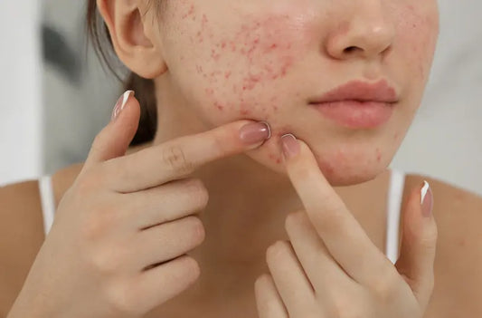 Easing Exam Stress With Heaven Heaven Skincare