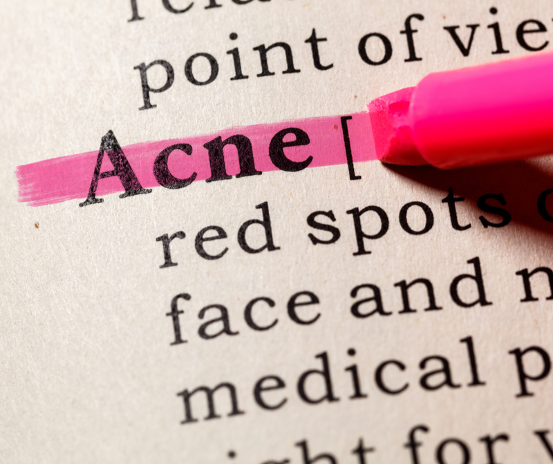 Pro Tips: Understanding Acne