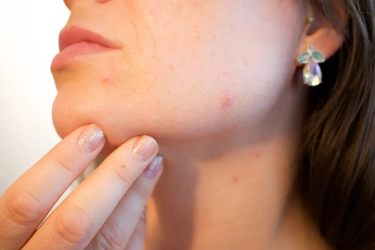 Pro-Tips: Skincare For Perimenopause