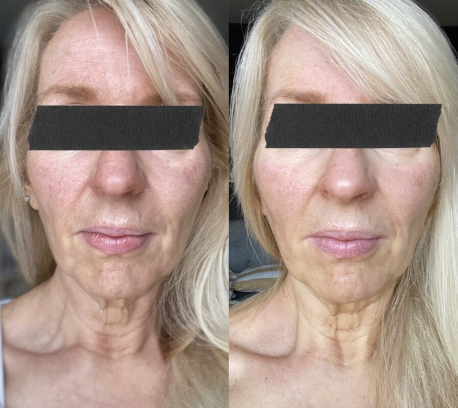 A BEAUTIFUL BEAUTY BOOST