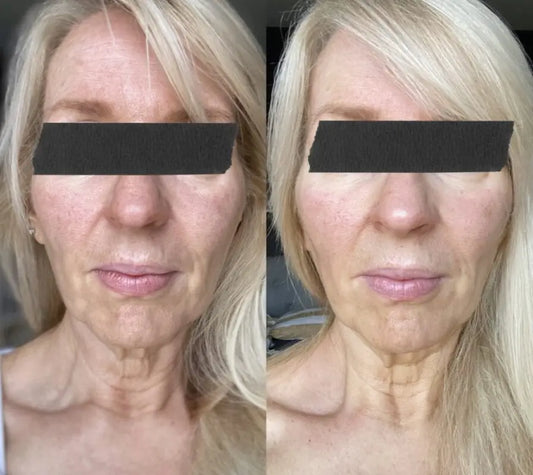 A BEAUTIFUL BEAUTY BOOST Heaven Skincare