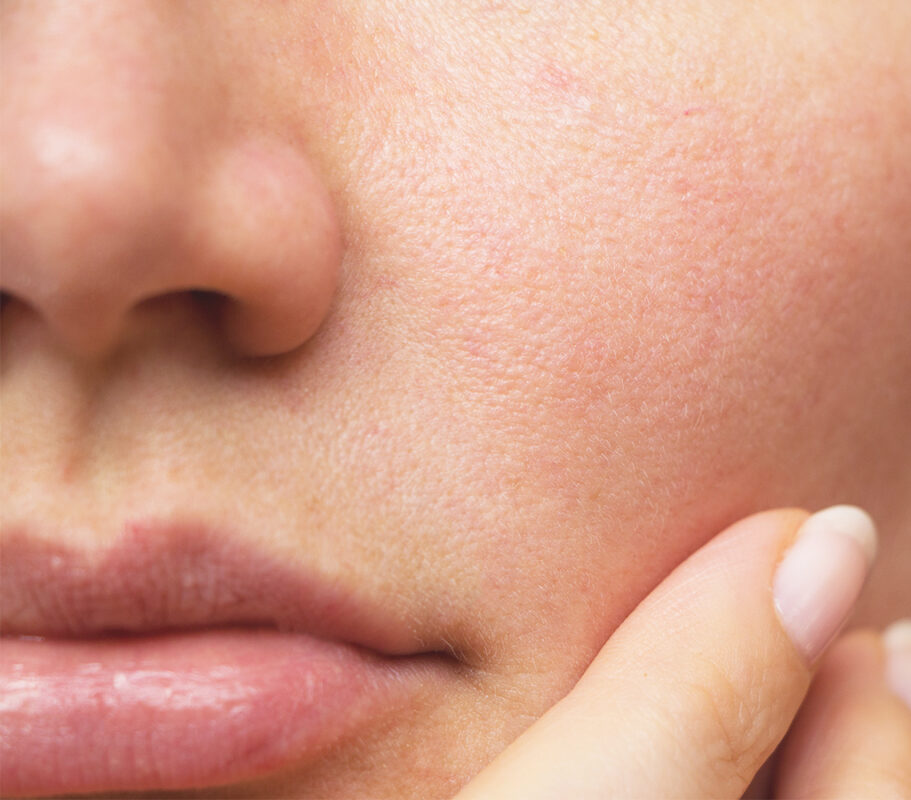 WHERE DO YOUR SPOTS APPEAR?